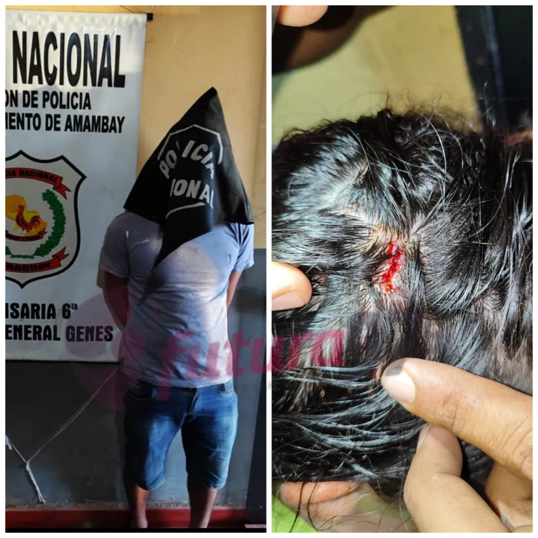 Aprehendido por agredir a su hermana con una botella