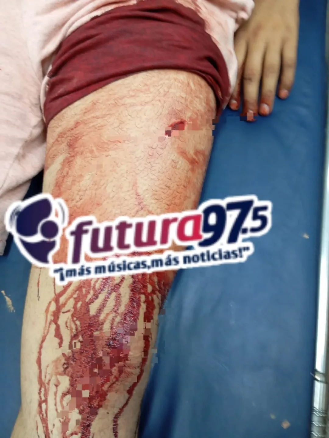 Joven herido durante un asalto en el barrio San Blas