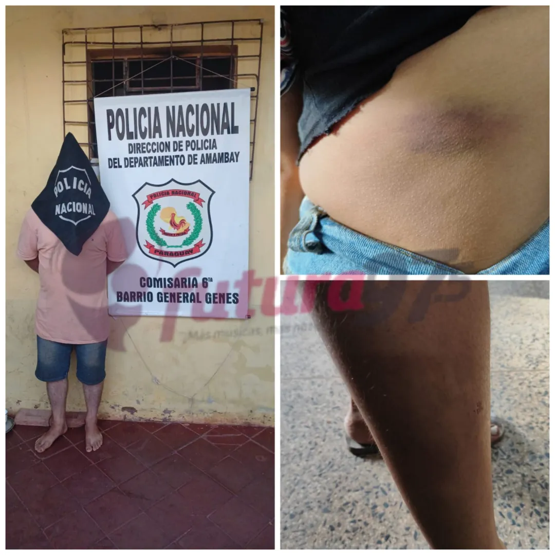 Hombre aprehendido por golpear y amenazar de muerte a su pareja